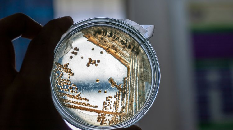 A Comprehensive Overview of Pichia pastoris Fermentation Methods: From Laboratory Shake Flasks to Industrial-Scale Production – Which Approach Should You Choose?