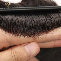 0608 Skin Knots (7)
