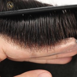 0204 Skin Knots (1)