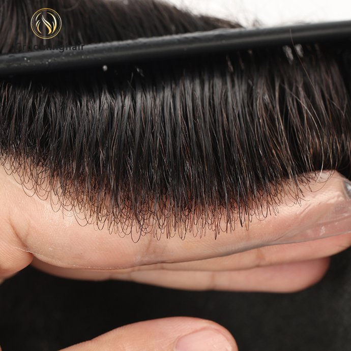 0204 Skin Knots (1)