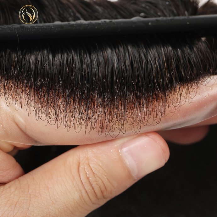 0406 Skin Knots (7)